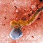 Syfilitida stále není nemocí minulosti