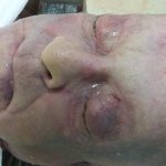 Potvrzeno! Muž nalezený u Schwarzenberského plavebního kanálu byl zavražděn