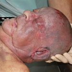 Zavražděný od Schwarzenberského kanálu je Němec. K identifikaci pomohl kyčelní implantát
