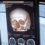 Nemocnice v Jindřichově Hradci má nový CT přístroj. Urychlí vyšetření a zkrátí čekací dobu