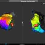 Nemocnice České Budějovice rozšiřuje léčbu srdečních arytmií o špičkový 3D systém