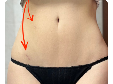 V Nemocnici Písek se operuje i bez šití. Lékaři rány lepí