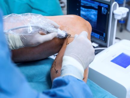 Chirurgická léčba křečových žil, hemoroidů i kýly je v Nemocnici Písek šetrná i účinná